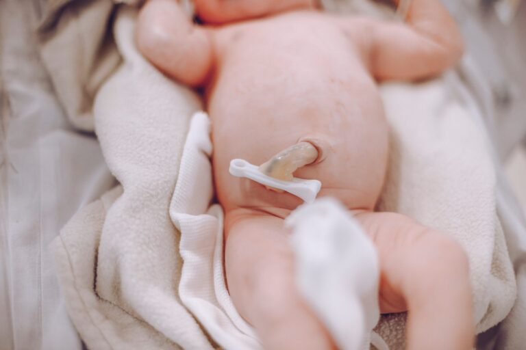 Caring For Your Baby’s Umbilical Cord Stump: Tips and Recognising Infection Signs