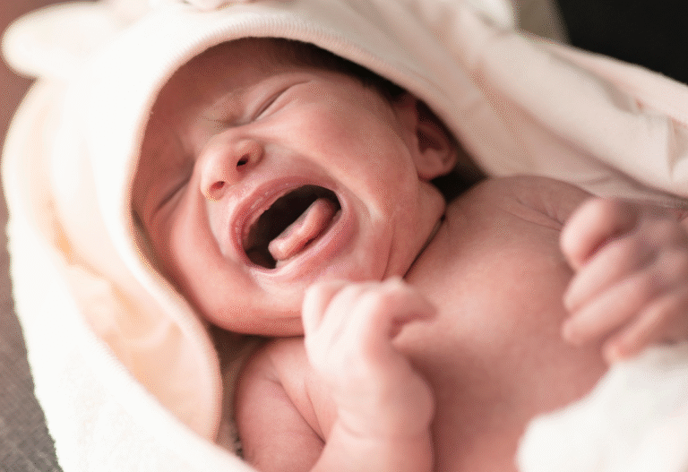 Understanding Reflux: What is the Best Position to Breastfeed a baby with Reflux? 